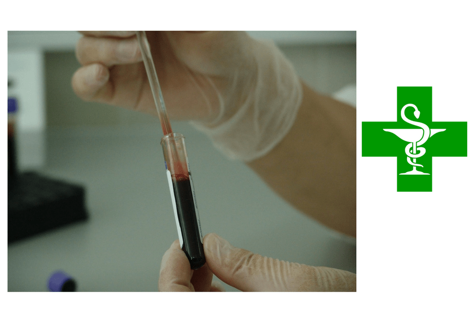 Diagnóstico precoz del VIH: nuevo reto para las oficinas de farmacia